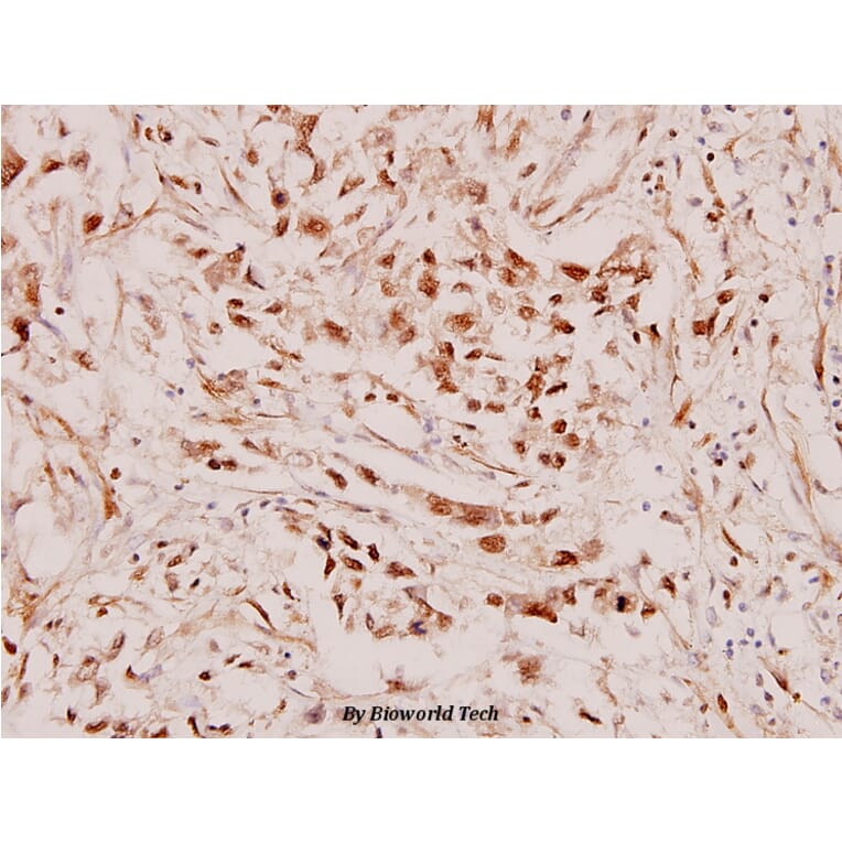 Anti-RARβ (L359) Antibody from Bioworld Technology (BS1315) - Antibodies.com