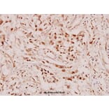 Anti-RARβ (L359) Antibody from Bioworld Technology (BS1315) - Antibodies.com