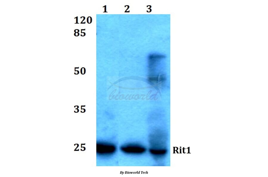 Anti-Rit1 (W204) Antibody from Bioworld Technology (BS1317) - Antibodies.com