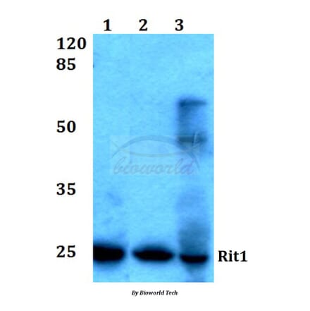 Anti-Rit1 (W204) Antibody from Bioworld Technology (BS1317) - Antibodies.com