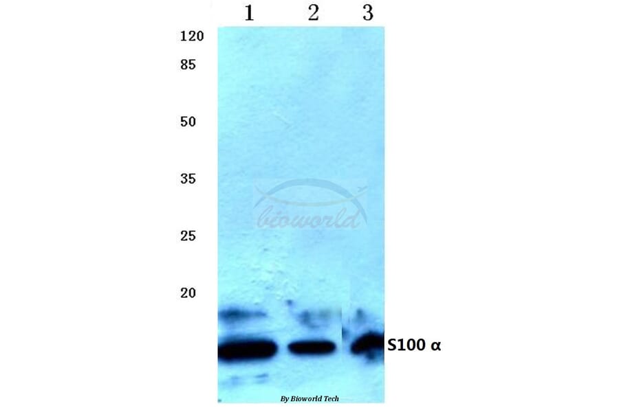 Anti-S100 α (A18) Antibody from Bioworld Technology (BS1318) - Antibodies.com
