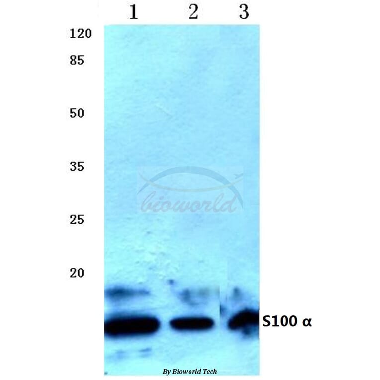 Anti-S100 α (A18) Antibody from Bioworld Technology (BS1318) - Antibodies.com