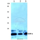 Anti-S100 α (A18) Antibody from Bioworld Technology (BS1318) - Antibodies.com