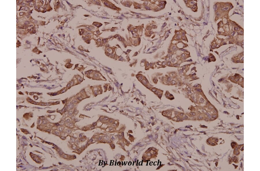 Anti-S100 α (A18) Antibody from Bioworld Technology (BS1318) - Antibodies.com
