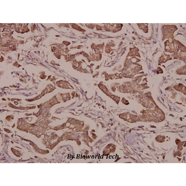 Anti-S100 α (A18) Antibody from Bioworld Technology (BS1318) - Antibodies.com