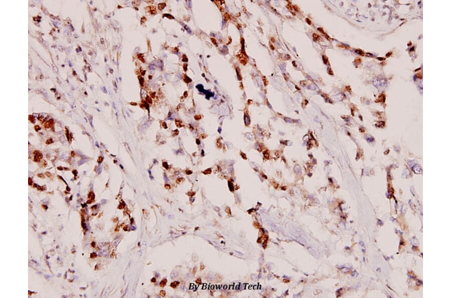 Anti-MEK-4 (V255) Antibody from Bioworld Technology (BS1319) - Antibodies.com