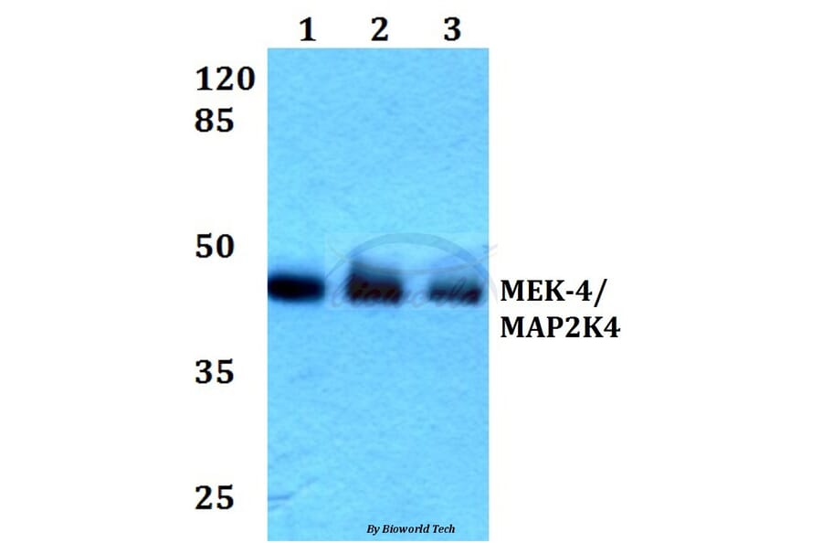 Anti-MEK-4 (E74) Antibody from Bioworld Technology (BS1320) - Antibodies.com