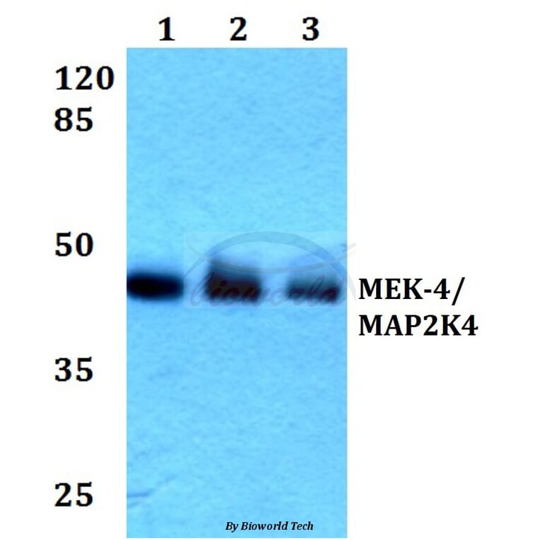 Anti-MEK-4 (E74) Antibody from Bioworld Technology (BS1320) - Antibodies.com