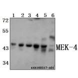 Anti-MEK-4 (E74) Antibody from Bioworld Technology (BS1320) - Antibodies.com