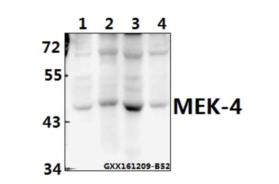 Anti-MEK-4 (E74) Antibody from Bioworld Technology (BS1320) - Antibodies.com
