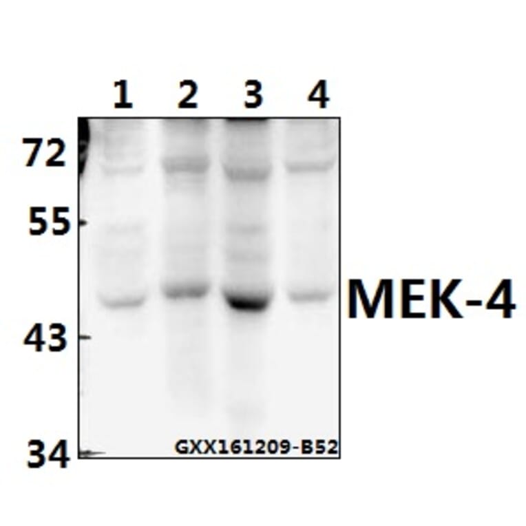 Anti-MEK-4 (E74) Antibody from Bioworld Technology (BS1320) - Antibodies.com