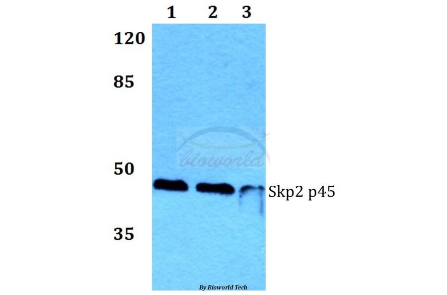 Anti-Skp2 p45 (P399) Antibody from Bioworld Technology (BS1325) - Antibodies.com