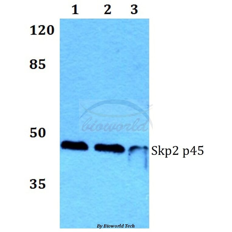 Anti-Skp2 p45 (P399) Antibody from Bioworld Technology (BS1325) - Antibodies.com