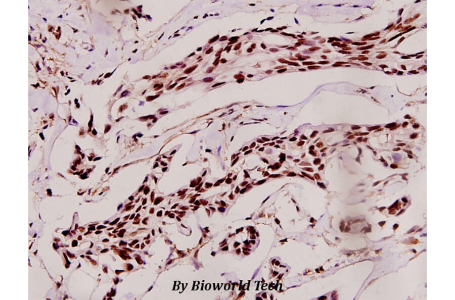 Anti-Skp2 p45 (P399) Antibody from Bioworld Technology (BS1325) - Antibodies.com