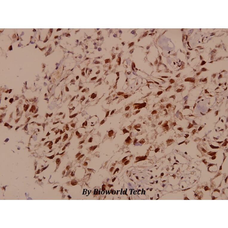 Anti-SMC 1 (S951) Antibody from Bioworld Technology (BS1326) - Antibodies.com