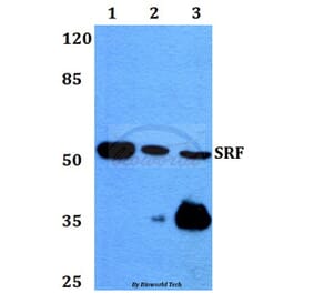Anti-SRF (G93) Antibody from Bioworld Technology (BS1332) - Antibodies.com