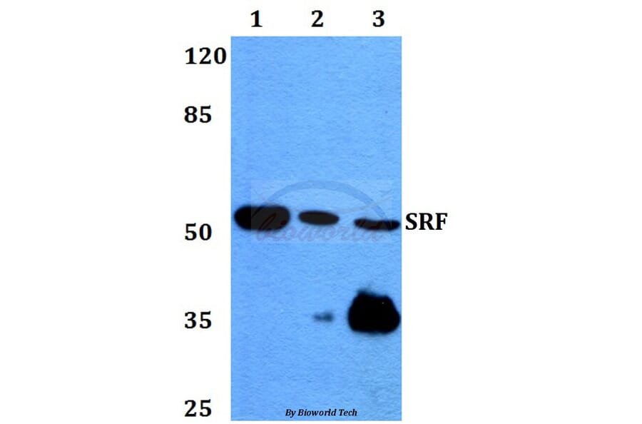 Anti-SRF (G93) Antibody from Bioworld Technology (BS1332) - Antibodies.com