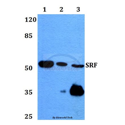Anti-SRF (G93) Antibody from Bioworld Technology (BS1332) - Antibodies.com