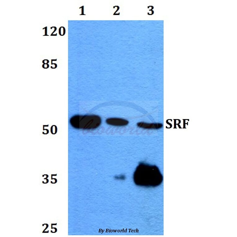 Anti-SRF (G93) Antibody from Bioworld Technology (BS1332) - Antibodies.com