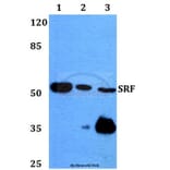 Anti-SRF (G93) Antibody from Bioworld Technology (BS1332) - Antibodies.com
