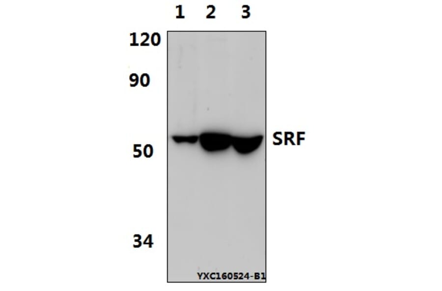 Anti-SRF (G93) Antibody from Bioworld Technology (BS1332) - Antibodies.com