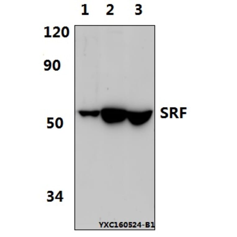Anti-SRF (G93) Antibody from Bioworld Technology (BS1332) - Antibodies.com