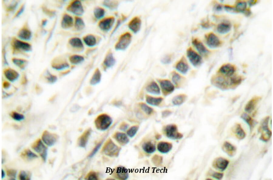Anti-SRF (G93) Antibody from Bioworld Technology (BS1332) - Antibodies.com