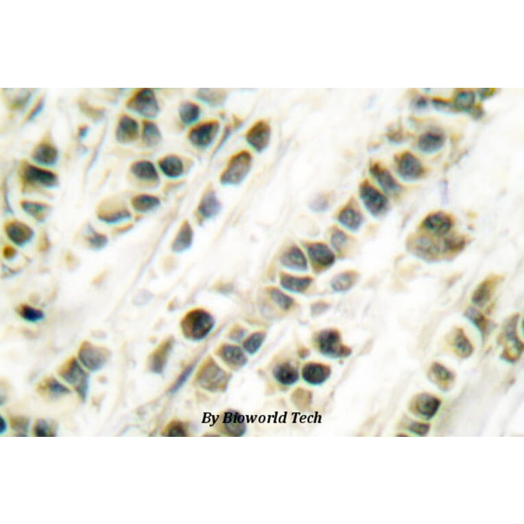 Anti-SRF (G93) Antibody from Bioworld Technology (BS1332) - Antibodies.com