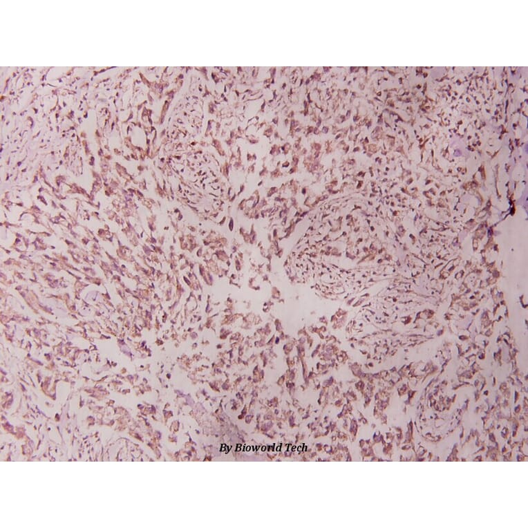 Anti-Stat1 (G695) Antibody from Bioworld Technology (BS1333) - Antibodies.com