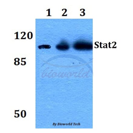 Anti-Stat2 (L684) Antibody from Bioworld Technology (BS1334) - Antibodies.com