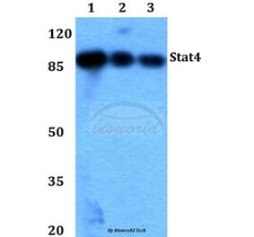 Anti-Stat4 (E687) Antibody from Bioworld Technology (BS1337) - Antibodies.com