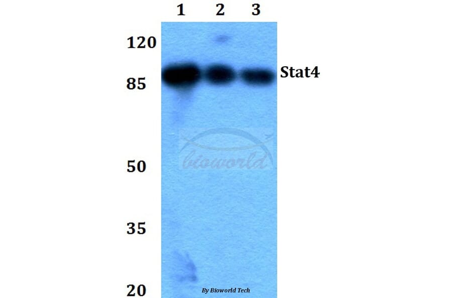 Anti-Stat4 (E687) Antibody from Bioworld Technology (BS1337) - Antibodies.com