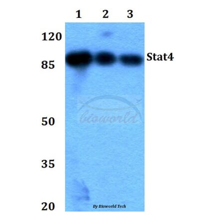 Anti-Stat4 (E687) Antibody from Bioworld Technology (BS1337) - Antibodies.com