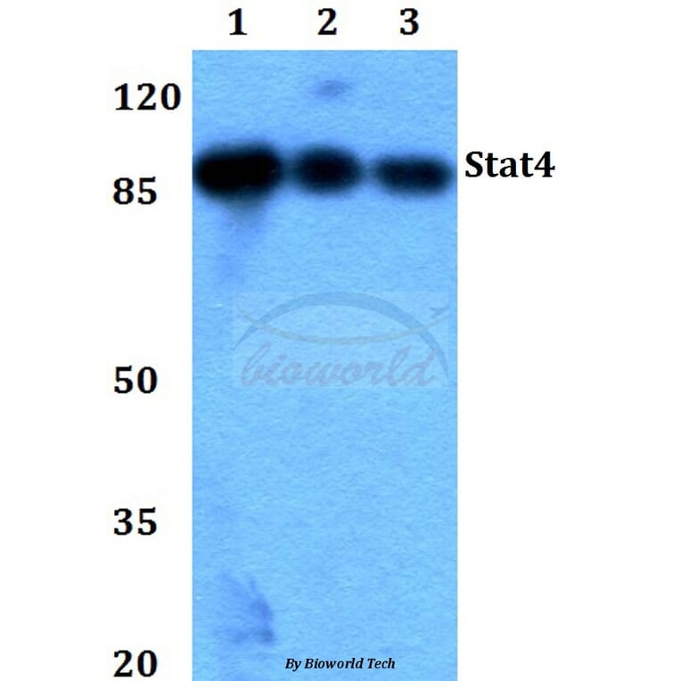 Anti-Stat4 (E687) Antibody from Bioworld Technology (BS1337) - Antibodies.com