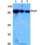 Anti-Stat4 (E687) Antibody from Bioworld Technology (BS1337) - Antibodies.com