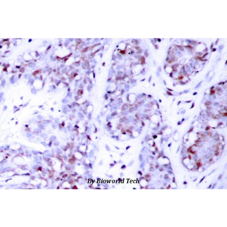 Anti-Stat4 (E687) Antibody from Bioworld Technology (BS1337) - Antibodies.com