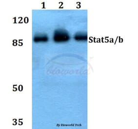 Anti-Stat5a/b (A688) Antibody from Bioworld Technology (BS1338) - Antibodies.com