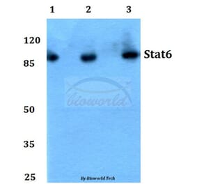 Anti-Stat6 (R639) Antibody from Bioworld Technology (BS1341) - Antibodies.com