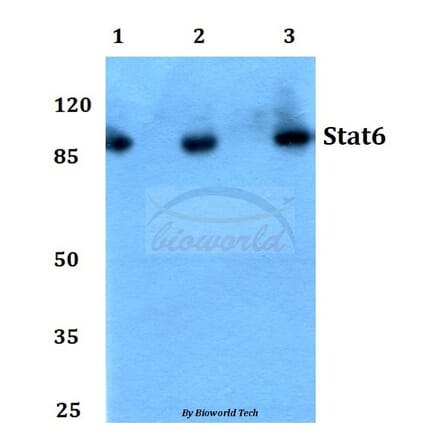 Anti-Stat6 (R639) Antibody from Bioworld Technology (BS1341) - Antibodies.com