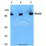 Anti-Stat6 (R639) Antibody from Bioworld Technology (BS1341) - Antibodies.com