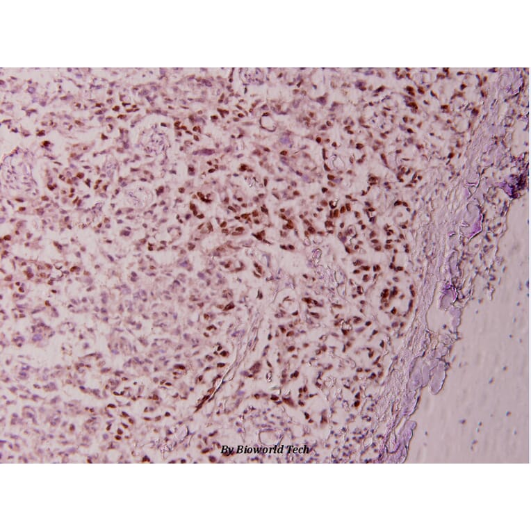 Anti-Stat6 (R639) Antibody from Bioworld Technology (BS1341) - Antibodies.com