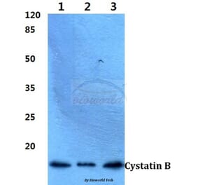 Anti-Cystatin B (N84) Antibody from Bioworld Technology (BS1342) - Antibodies.com