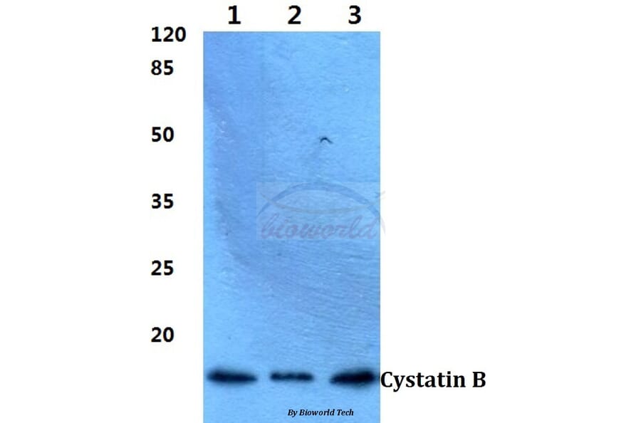 Anti-Cystatin B (N84) Antibody from Bioworld Technology (BS1342) - Antibodies.com