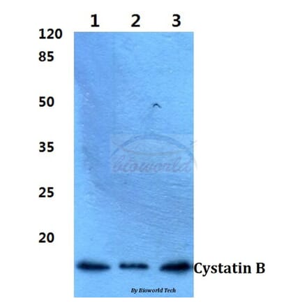 Anti-Cystatin B (N84) Antibody from Bioworld Technology (BS1342) - Antibodies.com