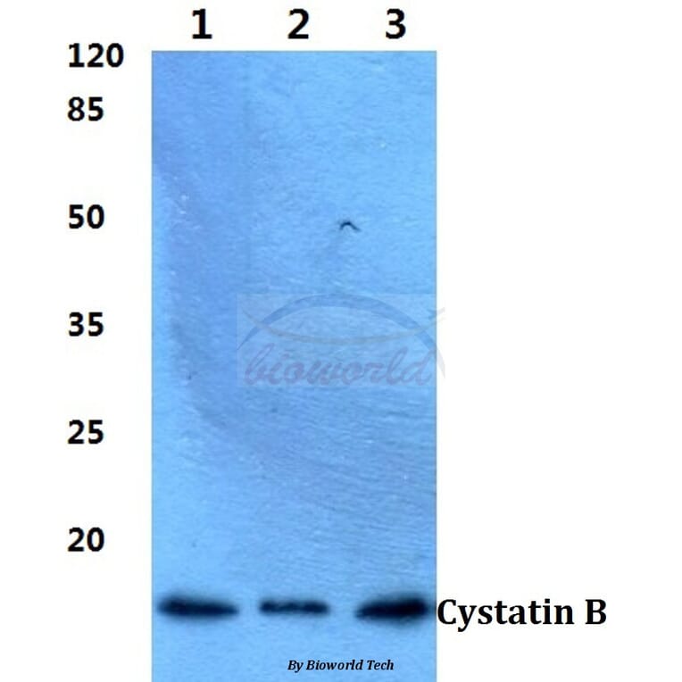 Anti-Cystatin B (N84) Antibody from Bioworld Technology (BS1342) - Antibodies.com