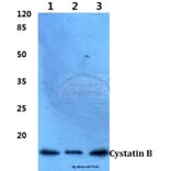 Anti-Cystatin B (N84) Antibody from Bioworld Technology (BS1342) - Antibodies.com