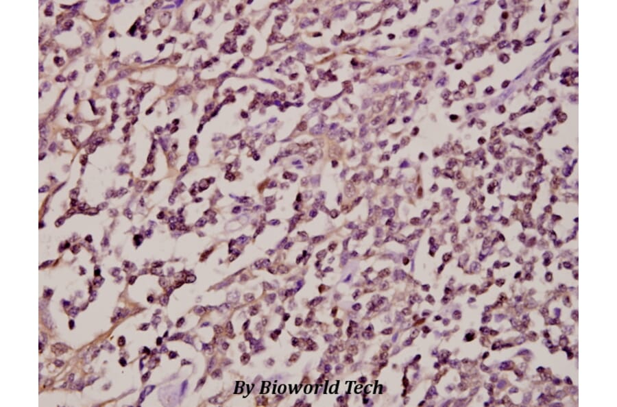 Anti-Syk (F169) Antibody from Bioworld Technology (BS1343) - Antibodies.com