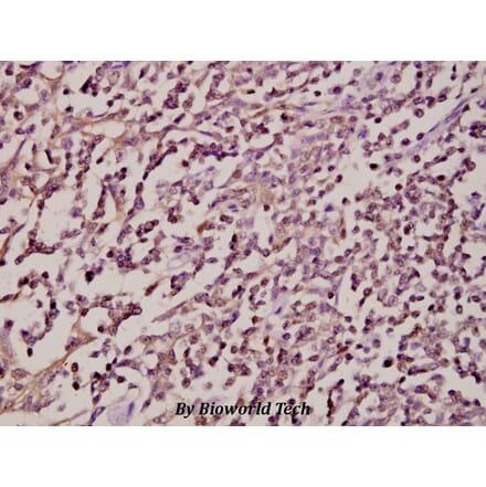 Anti-Syk (F169) Antibody from Bioworld Technology (BS1343) - Antibodies.com
