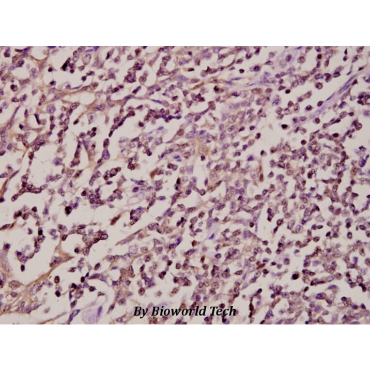 Anti-Syk (F169) Antibody from Bioworld Technology (BS1343) - Antibodies.com