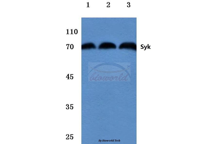 Anti-Syk (L519) Antibody from Bioworld Technology (BS1344) - Antibodies.com